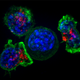 Tres células T atacan una célula cancerosa